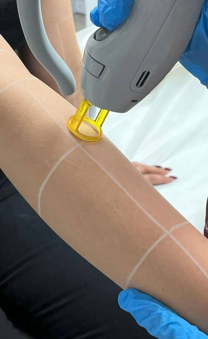 laser-shot